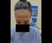 Unique Hair Gro Hair Transplant Clinic