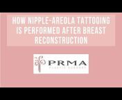 PRMA Plastic Surgery &#124; Center For Advanced Breast Reconstruction