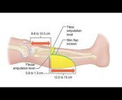 Orthopaedics u0026 Trauma in Youtube