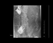 Yale Radiology and Biomedical Imaging