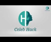 Celeb Hack