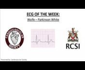 RCSI Cardiovascular Society