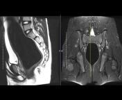First Look MRI- Power to the Patient