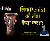 Cure Stone by Dr Deepanshu Gupta