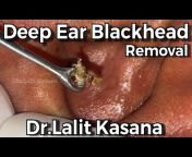 Dr. Lalit Kasana - Skin Treatment