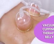 MOMMY TUMMY FIX- VACUUM CUPPING THERAPY BELLY TUMMY PART 3 &#124; myChway MS2183nnIn this video, I show you silicone cupping for cellulite on your stomach. I use this cupping therapy to help smooth lumps and bumps on my tummy (or mummy tummy as some would call it)nnBUY IT NOW : https://shop.mychway.com/itm/ms-2183nhttps://mychway.com/itm/1005531 nnVacuum Cupping Therapy for Face https://youtu.be/Dw3zpqMebFEnVacuum Cupping Therapy on Back https://youtu.be/ts3330zhwy8nnnCupping stimulates blood circula