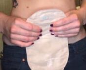 Laura Cox of Shield HealthCare shows how she changes her ostomy bag.