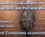 This is part 7 of the series of management of ano-genital warts. This is a case of giant anal warts (Gaint Anal Condyloma Acuminata). Patient had history of unprotected sex 2 years back after which he started developing anal warts. He tried all sorts of home remedies, he could find on google, but none of them worked on him. Finally he sought medical advise after one and half year of the occurence of warts. By this time the warts had grown to large size and had involved whole of anal canal and su