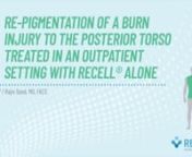 RECELL® System - Case Study XXX: Re-pigmentation of a Burn Injury to the Posterior Torso from à¦•à¦¾à¦•à¦¿à¦®à¦¾à¦°xxx