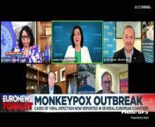 Many cases are being found in men who have sex with men, but monkeypox can spread through close contact regardless of sexual orientation.
