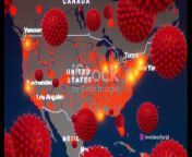 In a shocking turn of events, the United States is currently facing a severe measles outbreak in 2024. Join us as we dive deep into the details of this alarming situation and explore the potential threat it poses to public health.&#60;br/&#62;&#60;br/&#62;As the date is April 12, 2024, the race towards eliminating measles by 2024 seems to be in jeopardy. The outbreak has spread rapidly across various states, causing concern among health officials and the general population. &#60;br/&#62;Stay tuned as we provide you with the latest updates on the affected regions, the number of confirmed cases, and the measures being taken to contain the outbreak.&#60;br/&#62;&#60;br/&#62;Our team of seasoned journalists has conducted in-depth interviews with leading medical experts, epidemiologists, and government officials to shed light on the root causes of this outbreak. &#60;br/&#62;We&#39;ll examine the factors contributing to the spread of measles, including low vaccination rates, misinformation campaigns, and the challenges faced by healthcare systems in responding effectively.&#60;br/&#62;&#60;br/&#62;Furthermore, we&#39;ll explore the importance of vaccination as a crucial tool in preventing the spread of measles. Hear from healthcare professionals who are working tirelessly to administer vaccines and educate communities about the benefits and safety of immunization.&#60;br/&#62;&#60;br/&#62;Through powerful visuals and expert analysis, we aim to raise awareness about the seriousness of this outbreak and the potential consequences if swift action is not taken. &#60;br/&#62;Join us in understanding the implications of this public health crisis and the urgent need for collective efforts to protect vulnerable populations, including children and individuals with compromised immune systems.&#60;br/&#62;&#60;br/&#62;&#60;br/&#62;Don&#39;t miss this crucial report on the measles outbreak of 2024. Together, let&#39;s stay informed, take proactive measures, and work towards eliminating this threat to public health.&#60;br/&#62;&#60;br/&#62;#MeaslesOutbreak2024&#60;br/&#62;#PublicHealthCrisis&#60;br/&#62;#ProtectOurCommunity&#60;br/&#62;#VaccinesSaveLives&#60;br/&#62;#StopMeaslesSpread&#60;br/&#62;#HealthEmergency&#60;br/&#62;#MeaslesThreat&#60;br/&#62;#DiseasePrevention&#60;br/&#62;#NationalHealthSecurity&#60;br/&#62;#MeaslesEradication&#60;br/&#62;#MeaslesAwareness&#60;br/&#62;#VaccinateToEliminate&#60;br/&#62;#HealthDefense&#60;br/&#62;#UnitedAgainstMeasles&#60;br/&#62;#MeaslesFreeUS&#60;br/&#62;#CommunityImmunity&#60;br/&#62;#TakeActionNow&#60;br/&#62;#PublicSafetyFirst&#60;br/&#62;#MeaslesControl&#60;br/&#62;#StayInformedStaySafe.