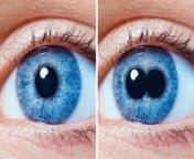 Our bodies are like a box of surprises, right? Sometimes, you stumble upon some real head-scratchers. Like, imagine having two pupils in one eye – talk about seeing double! And then there are folks born with extra fingers or toes, like nature&#39;s saying, &#92;