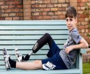 This little boy lost his foot at 18 months but became a model and now he travels the world posing for famous brands. Despite his impairment, the boy participated in as many sports and running clubs as possible as he got older.