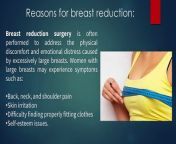 Breast have a very important role in female beauty. They help to give an attractive feminine look but at the same time if they grow out of proportion to rest of the body then they become the cause of embarrassment and frustration.