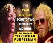 An early target for abuse because of his albinism, Yellowman grew up in an institution, Maxfield Children&#39;s Home and Alpha Boys&#39; School in Kingston with the likes of Leroy ‘Horsemouth’ Wallace and Johnny Osbourne with little to keep him company besides music. Like Yellowman, Purple Man&#39;s Albinism made him a novelty, though not as big a star.