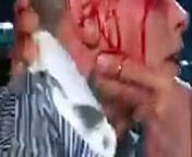 The Rock made Cody Rhodes bleed on WWE RAW 25 March 2024 Show from wwe leak